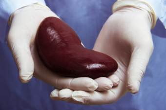 transplant de rinichi